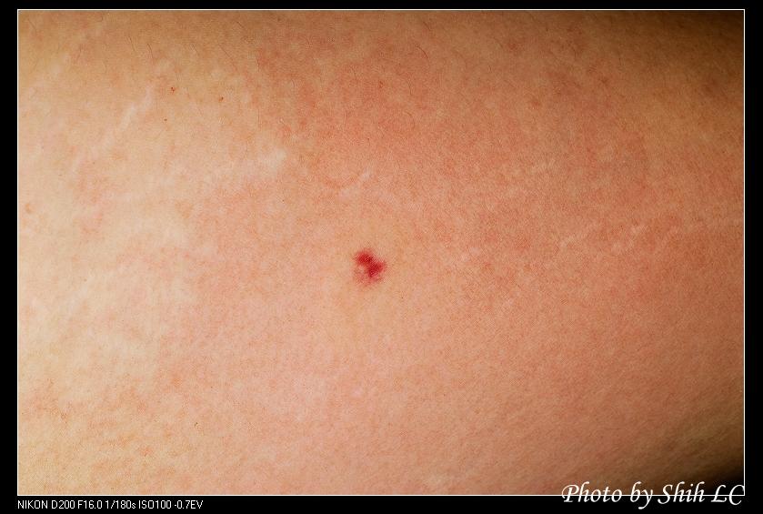 按此在新視窗瀏覽圖片