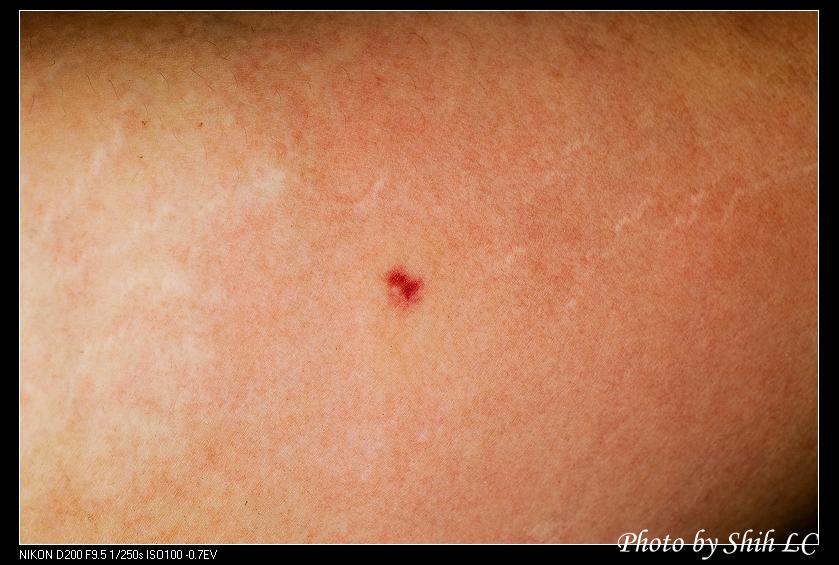 按此在新視窗瀏覽圖片